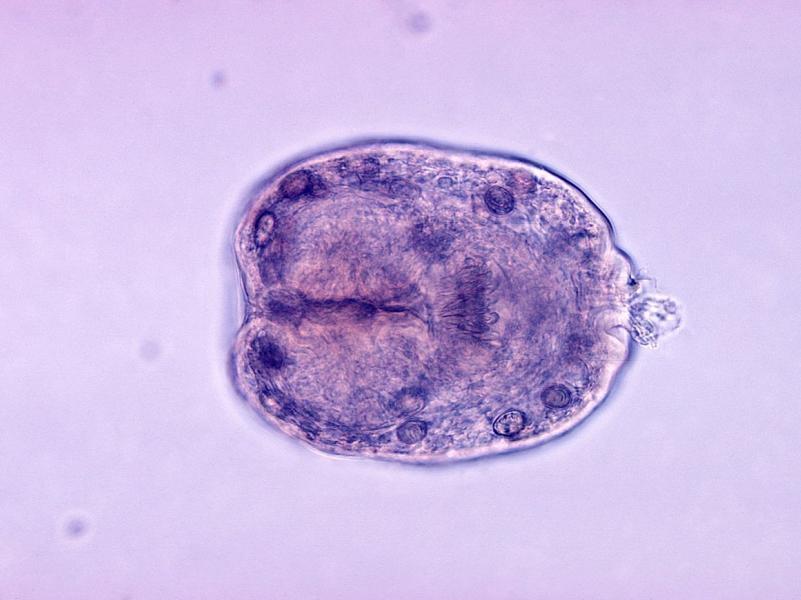 ÐÐ¸ÑÑÐ¾Ð»Ð¾Ð³Ð¸ÑÐµÑÐºÐ¸Ð¹ Ð¿ÑÐµÐ¿Ð°ÑÐ°Ñ Echinococcus granulosus quziqzkikqidzzglv